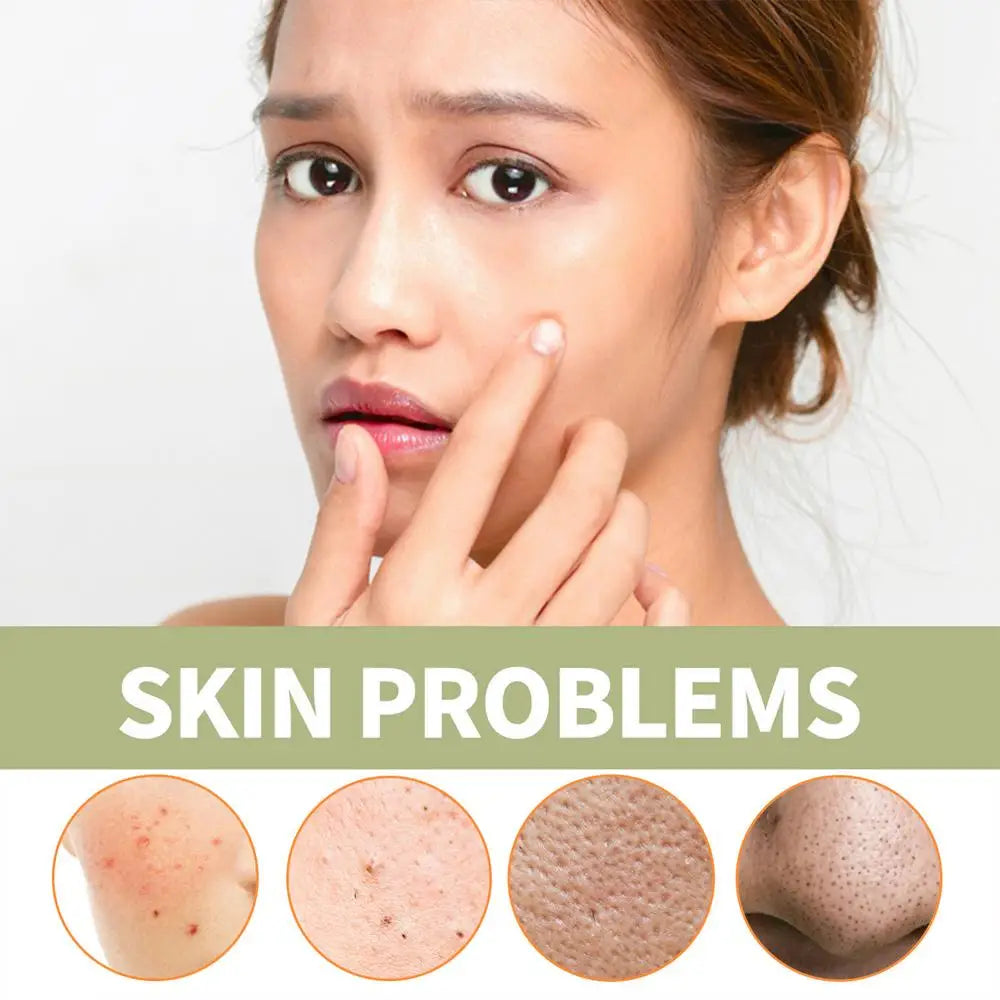 Moisturizing Clay Face Cover Mugwort Facial Acne Removing Mud Mask Cleaning facial mask Shrink pores moisturize control oil