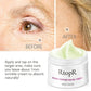 RtopR Anti-wrinkle Cream
