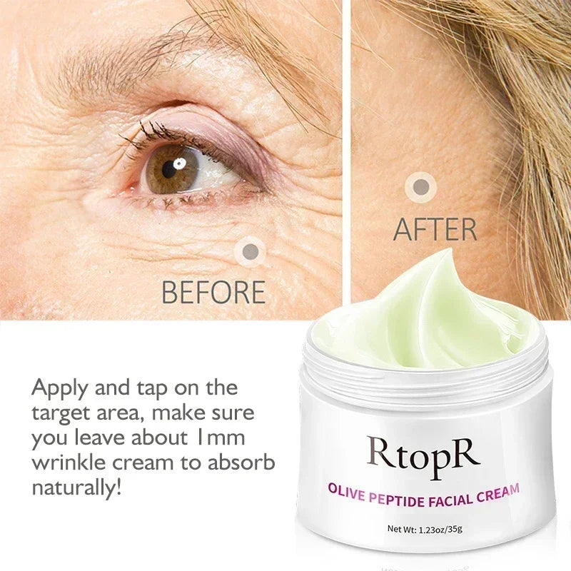 RtopR Anti-wrinkle Cream