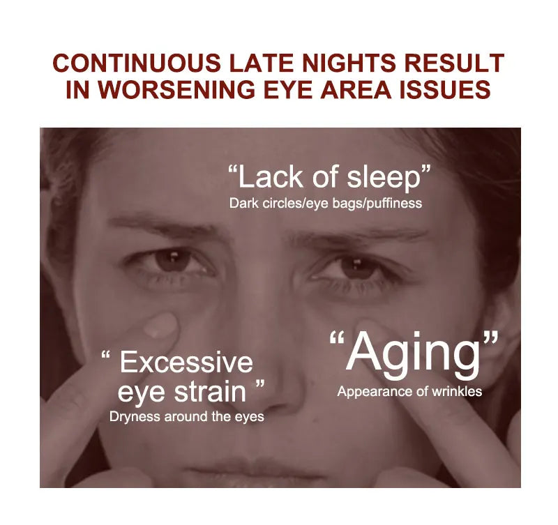 Anti Dark Circle Eye Cream