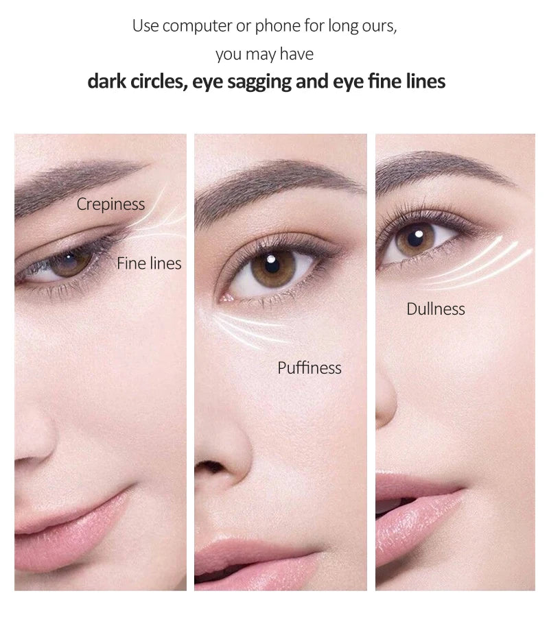 Anti Dark Circle Eye Cream
