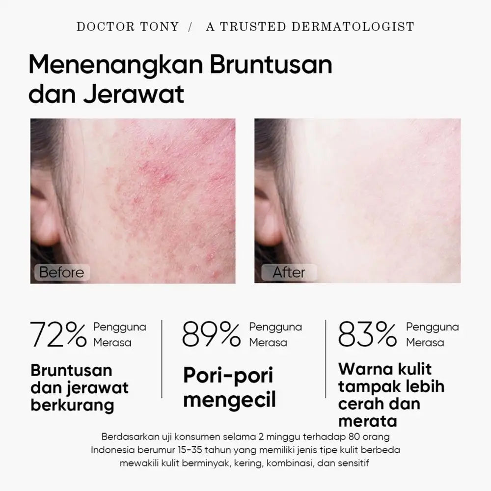 Moisturizing Clay Face Cover Mugwort Facial Acne Removing Mud Mask Cleaning facial mask Shrink pores moisturize control oil