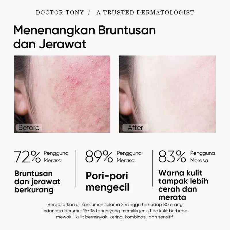 Moisturizing Clay Face Cover Mugwort Facial Acne Removing Mud Mask Cleaning facial mask Shrink pores moisturize control oil