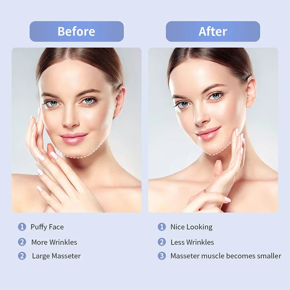 Electric V Face Facial Machine V-Line Up Lift Belt