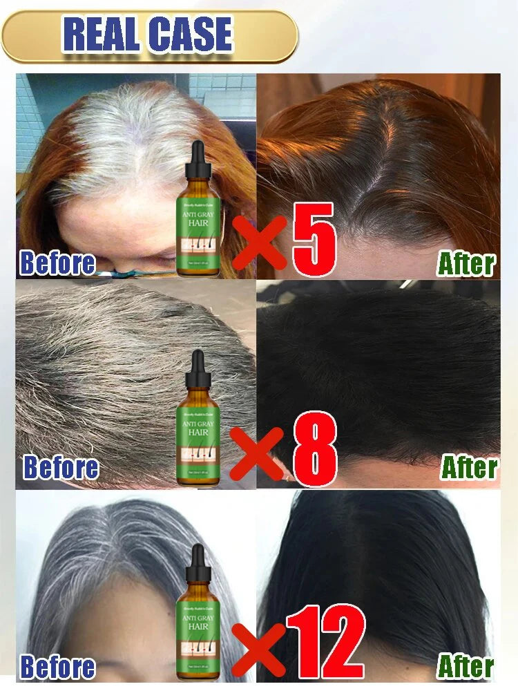Gray Hair Treatment Essence Oil Serum White to Black Natural Color Repair Nourishing Products Anti-Hair Loss Care For Men Women
