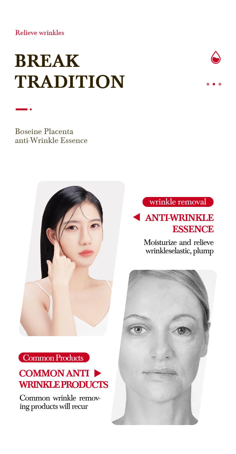 Boseine Placenta  25pcs Serum