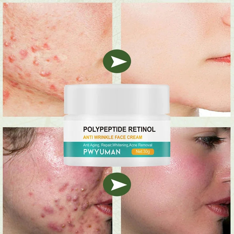 Instant Retinol Lifting Firming Cream