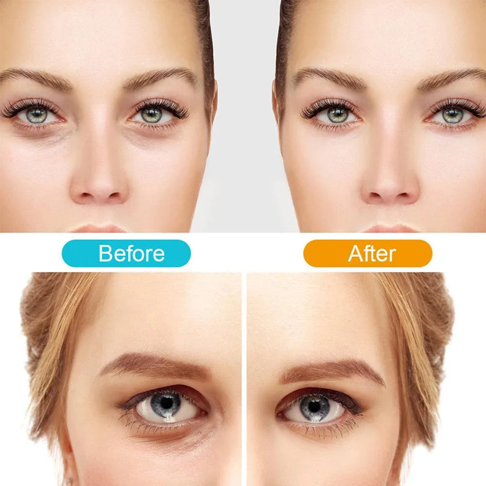 NEW 3D Eye Beauty Instrument