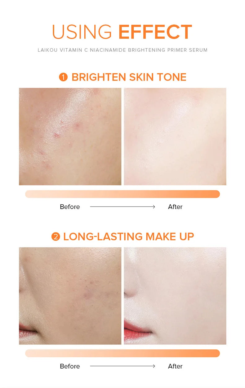 Skincare Vitamin C Face Serum
