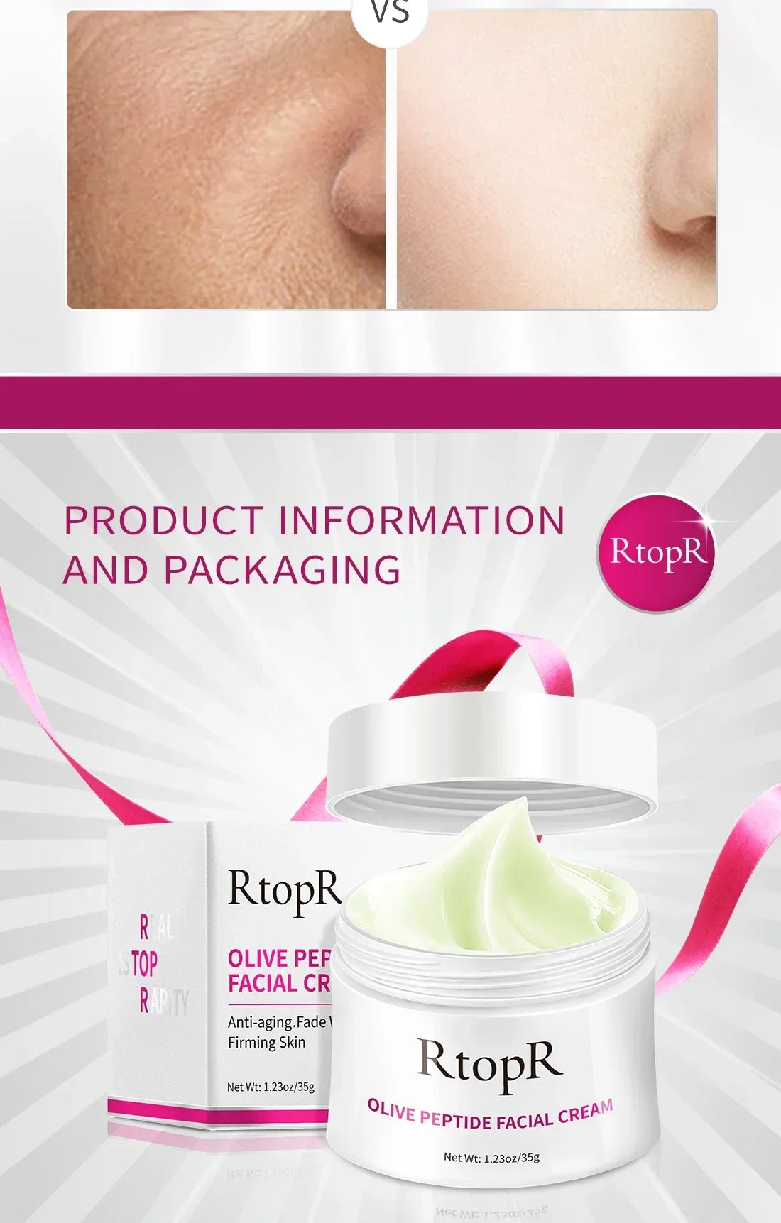 RtopR Anti-wrinkle Cream