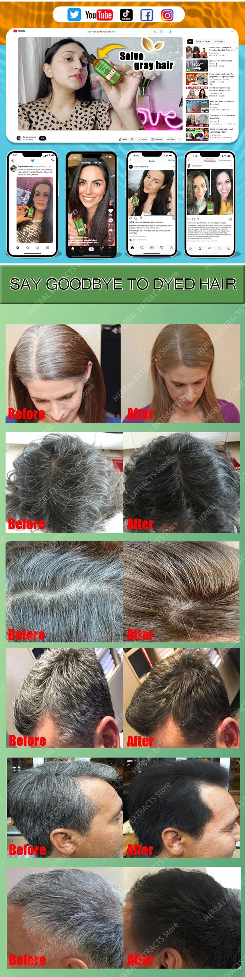 Gray Hair Treatment Essence Oil Serum White to Black Natural Color Repair Nourishing Products Anti-Hair Loss Care For Men Women