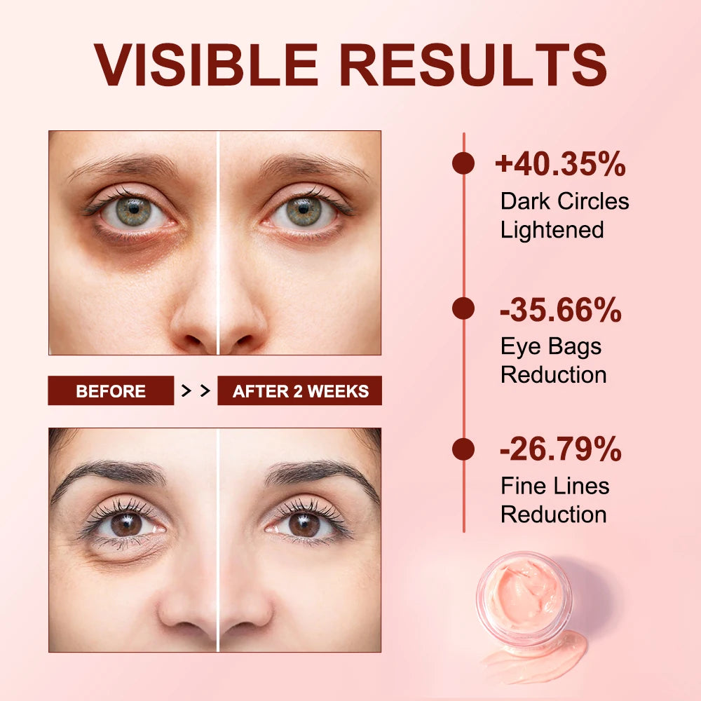 Anti Dark Circle Eye Cream