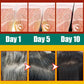 Gray Hair Treatment Essence Oil Serum White to Black Natural Color Repair Nourishing Products Anti-Hair Loss Care For Men Women